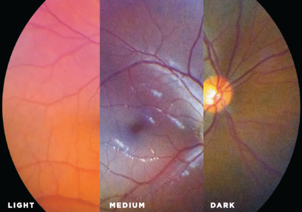 Cámara Retinal Midriática Portátil Volk VistaView - Image 5